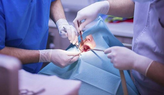 Problemas que puede solucionar la cirugía oral y maxilofacial
